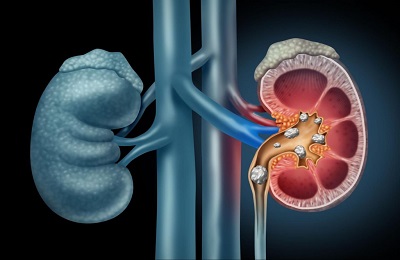 Nephrology 2026-Scientific-Sessions-2